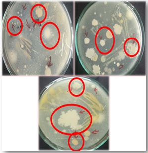 Kerotinolytic Bacteria